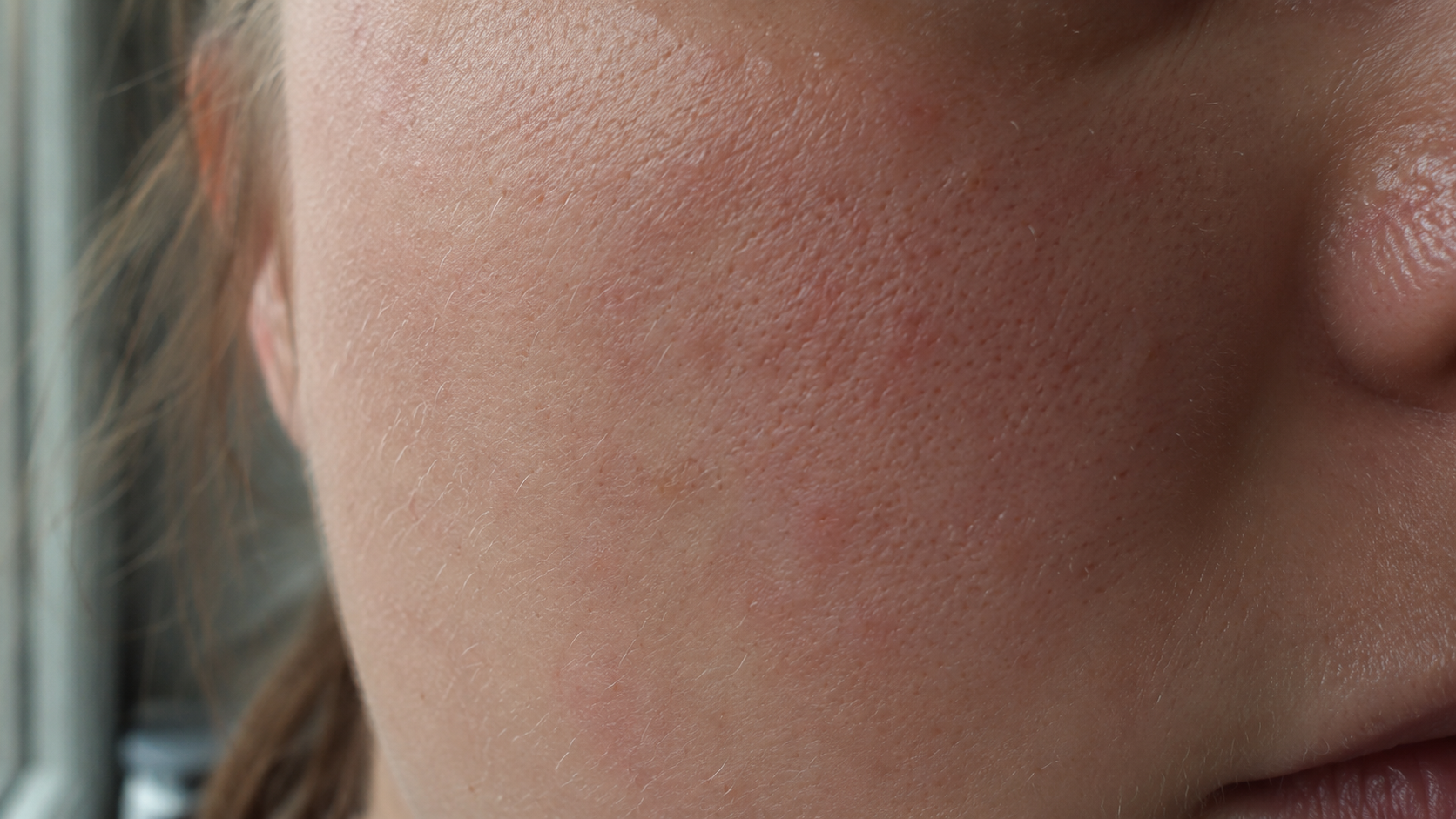 Film-Style Skin Realism: Calibrating Macro Cheek Photography Beyond Generic AI Beauty